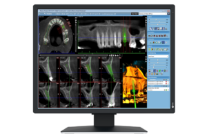 EIZO MX217-HB 21 Zoll (Tageslicht)