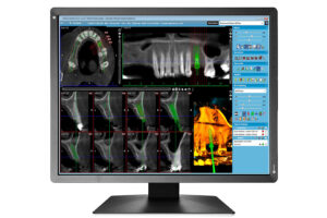 EIZO MX217-SB 21 Zoll