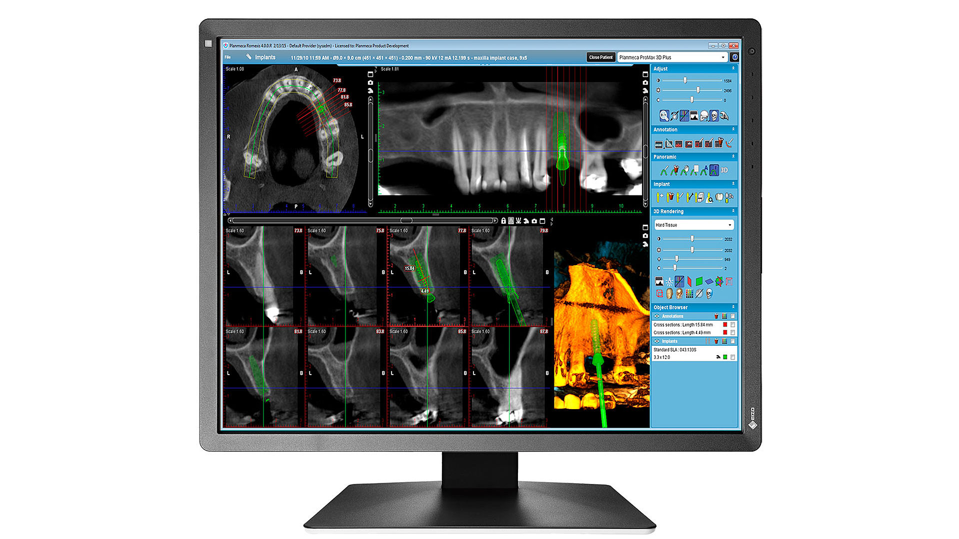 mx216-sb-dff.jpg mx216-sb-dff.jpg