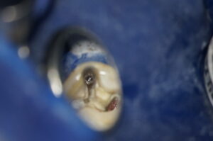 DSC03254-300×199 DSC03254-300×199