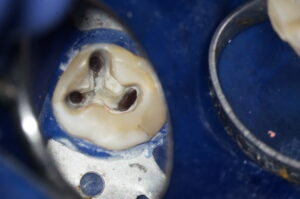 DSC03260-300×199 DSC03260-300×199