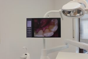Monitorset mit HD Kamera