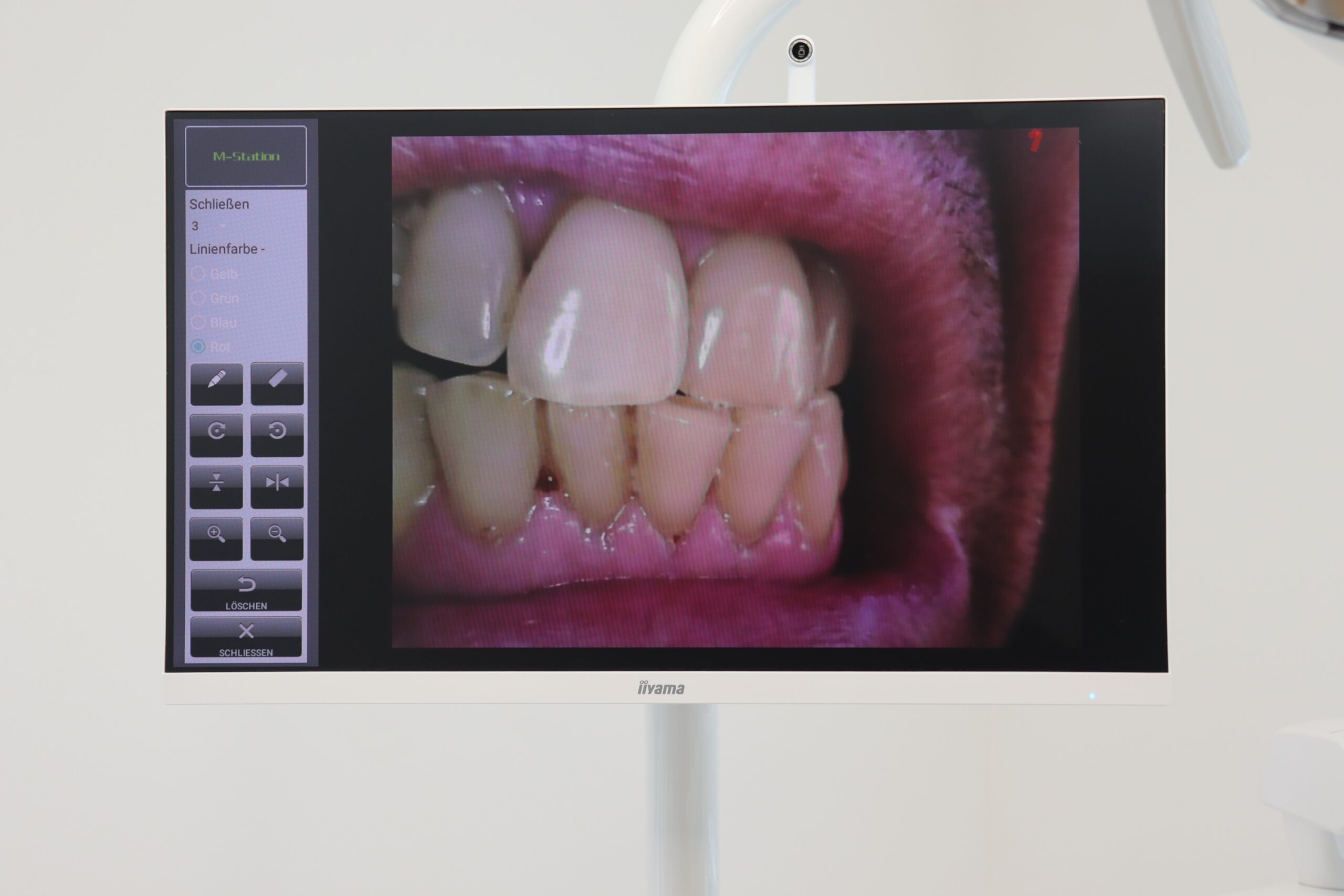 Monitor-6